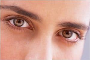 Radiation Induced Cataracts